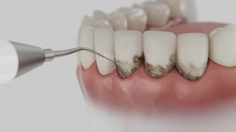 Trusted Tooth Extraction service in East St. Louis, IL - Dentist Open Now